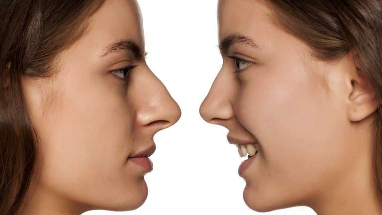 How Do Nose Augmentations Work?